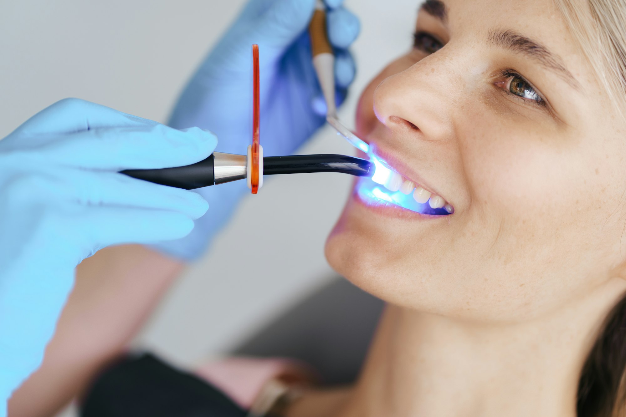 Dentist hands using dental UV curing light led laser