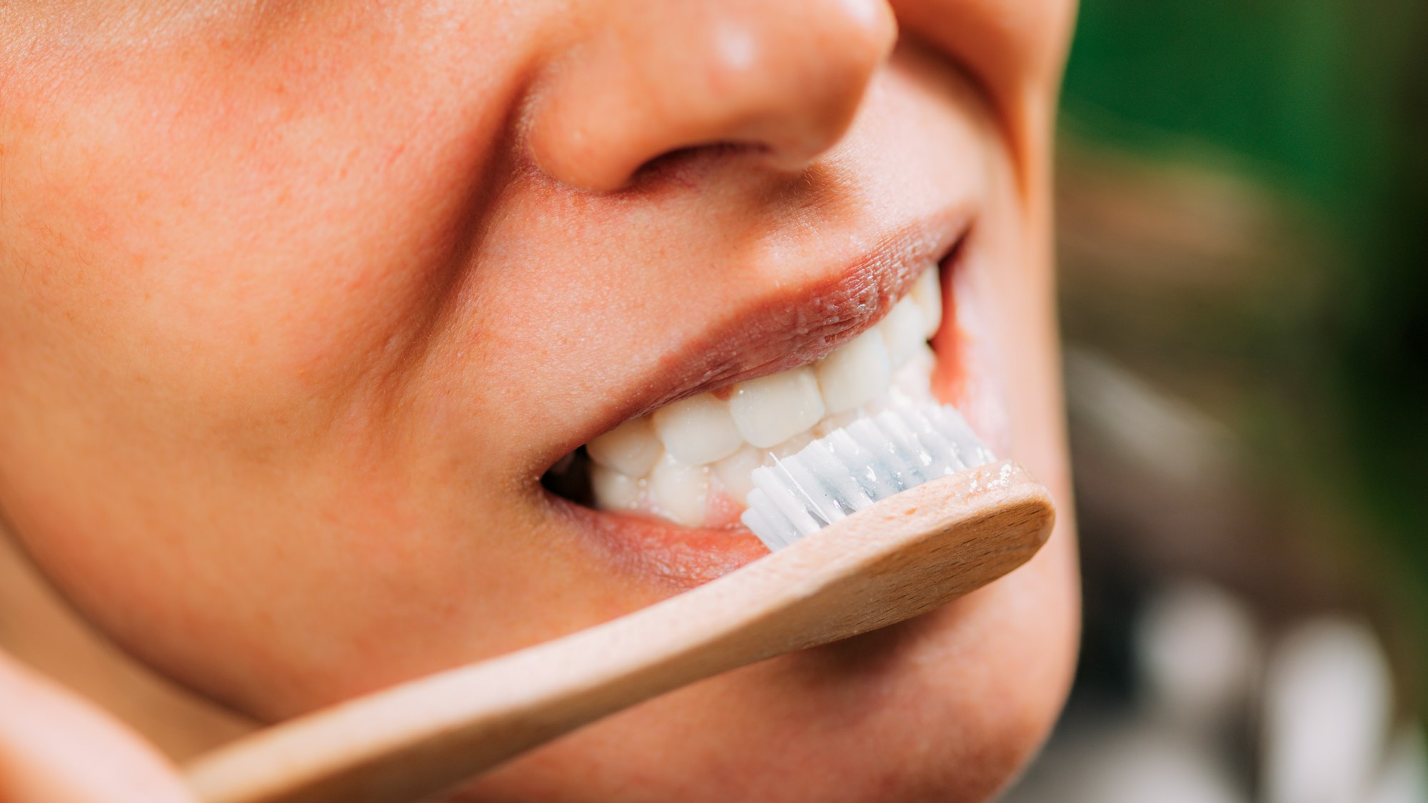 Whitening Teeth at Home.